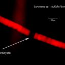 Die Fluoreszenz zeigt, dass Heterozysten keinerlei Chlorophyll enthalten.